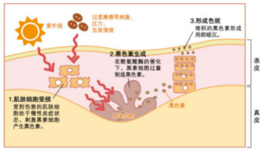 美白方法用不对,到了夏天黑三倍!