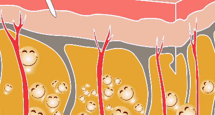 艾米丽程红涛吸脂瘦腿吸脂专业吗?