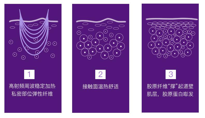 以色列Silkn 丝可荣登热门网综《种草吧！麻麻》 掀起私密护理新热潮