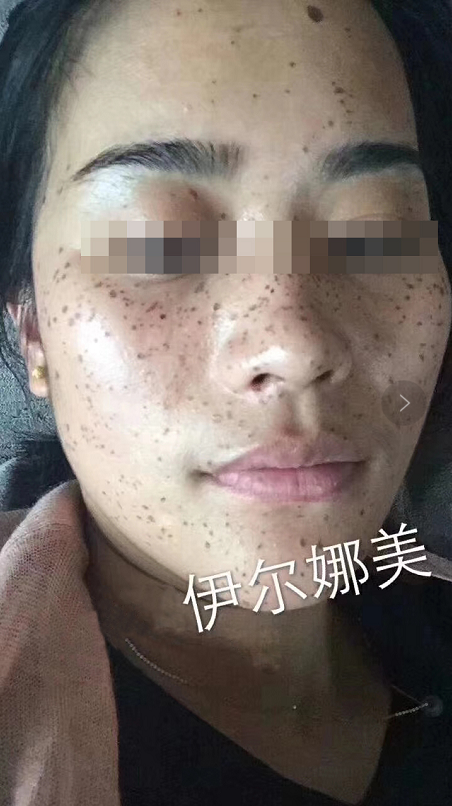 女人长斑影响颜值,伊尔娜美由内而外释放自然美