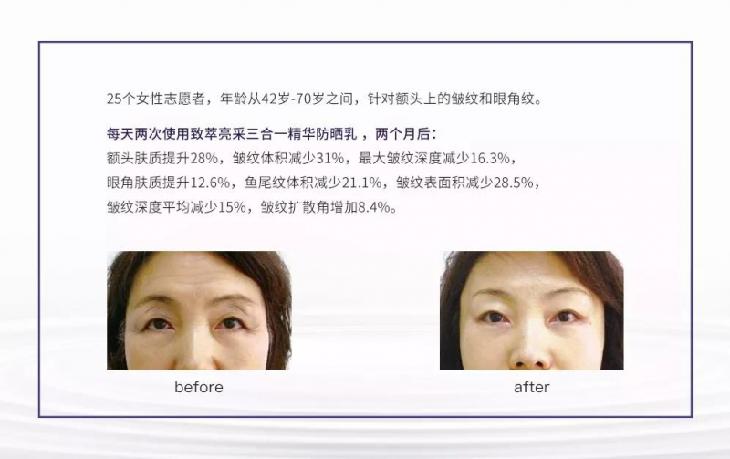 ioma艾欧码无惧紫外线，成就养肤级防晒