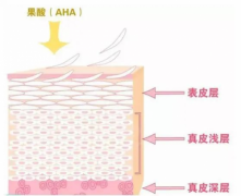 不同种类的酸应该如何选择？